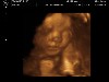 Sonogram 